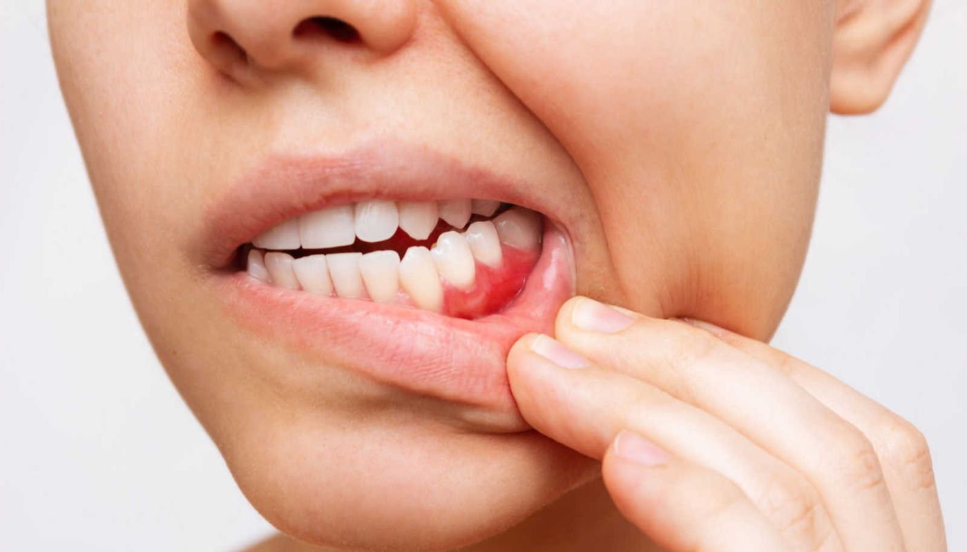 Odontoiatria conservativa